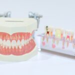 現役の口腔歯科医師が教える。歯学部の現状、大学数とその推移、一般入試、推薦入試、センター利用などの記事です。